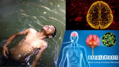 देश के इस राज्य में तेजी से बढ़ रहा &lsquo;दिमाग खाने वाले अमीबा&rsquo; का खौफ, एक और व्यक्ति की मौत